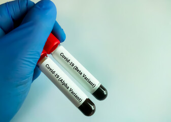 Scientist hold blood samples for Covid-19 Delta variant and Alpha variant testing. copy space