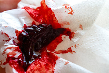 Photo of a period blood clot 