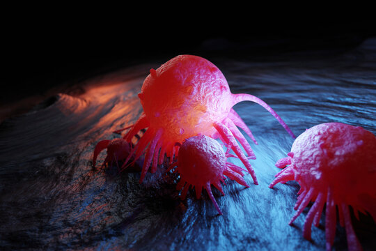 3D Illustration of cancer cells attacking in human body