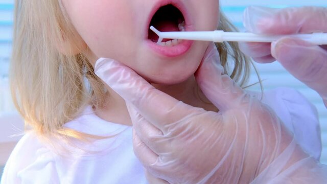 closeup female hands, dentist, doctor examines oral cavity of small patient, blonde girl 2 years old, molars grow, kid with open mouth, close up of child&rsquo;s mouth, white teeth