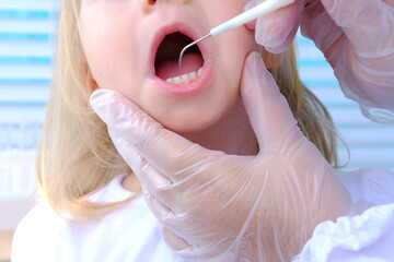 closeup female hands, dentist, doctor examines oral cavity of small patient, blonde girl 2 years...