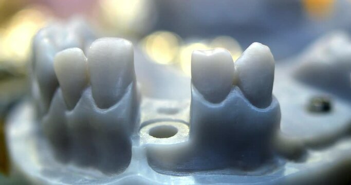 Objects photopolymer printed on stereolithography 3D printer