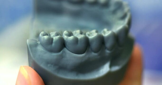 Objects photopolymer printed on stereolithography 3D printer