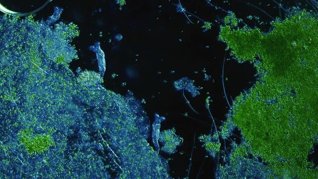 Rotifer colony under microscope. Stunning micro world with lot of microorganisms
