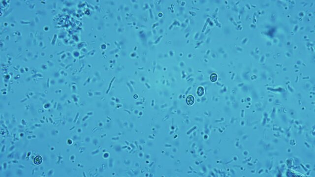Human dental plaque under a microscope. Thousands of different bacteria are visible in the frame. Staphylococcus, Streptococcus, Candida and yeast bacterias in the frame