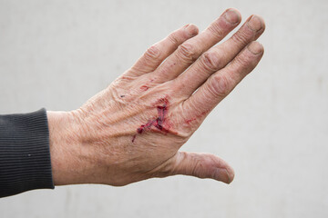 Fototapeta premium bloody and dirty left hand of a working man from the back