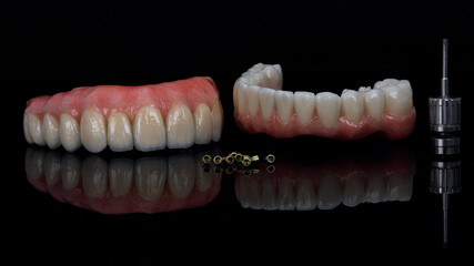 composition on black glass of two dental prostheses of the upper and lower jaws with screws and a screwdriver