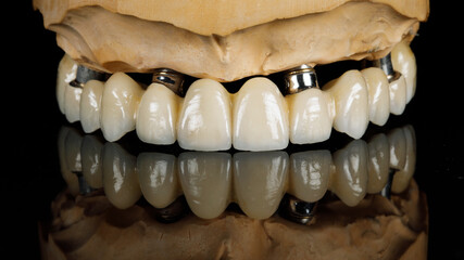 dental prosthesis of the upper jaw made of zirconium on black glass with reflection © Dental Pro Content
