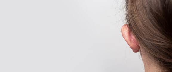 Female lop-eared protruding ear rear view on a light background. Otoplasty, plastic of the auricle....