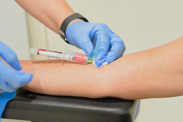 Nurse takes a blood sample, with a prick on the forearm of a patient. Rapid antibody diagnostic procedure.Steps in the process of a serology, antibodies and immunity - obrazy, fototapety, plakaty