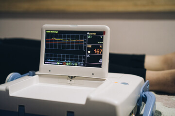 CTG Device, Fetal heartbeat monitor, cardiotocography