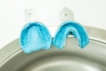 dental impression molds
