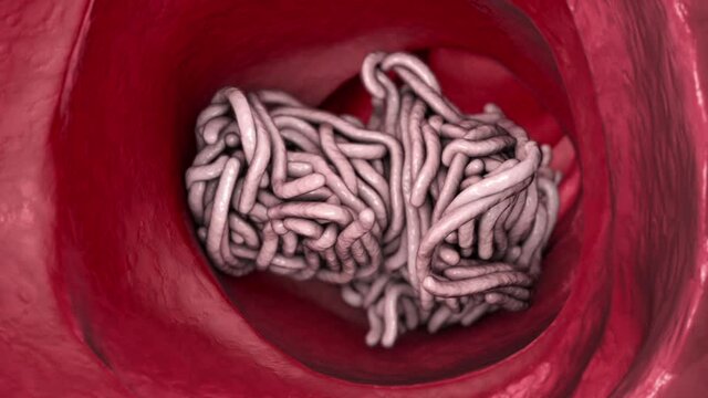 Parasitic worms in intestine, animation