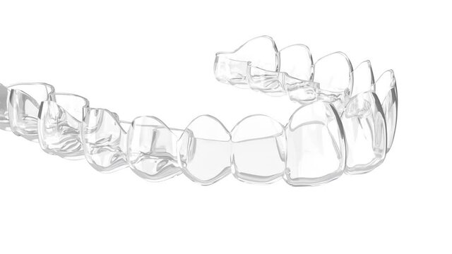 Upper, clear and removable retainer movement over white background