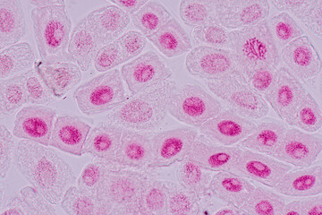 Root tip of Onion and Mitosis cell in the Root tip of Onion under a microscope.
