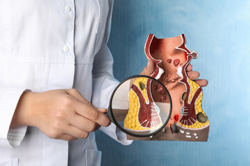 Doctor with magnifying glass showing model of unhealthy lower rectum on light blue background,...