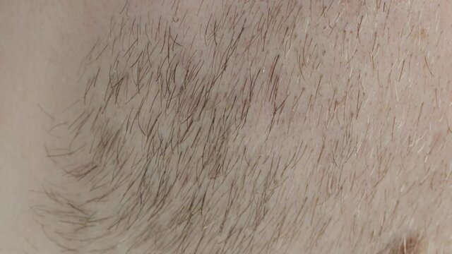 The texture of the red stubble on the beard of a young man, macro. Fine hairs, dermatology