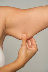 a woman pinches and shows the fat on her hands