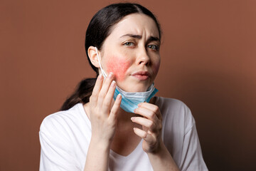 Maskne. Portrait of a young Caucasian upset woman shows irritation on her cheeks from wearing a...