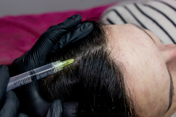 Procedure of mesotherapy. The doctor cosmetologist makes the procedure of mesotherapy in woman