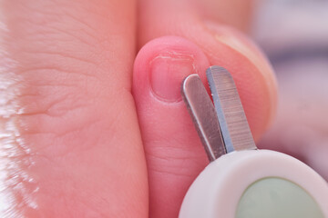 Cutting nails with special scissors on the fingers of a newborn baby, children manicure and cutting burrs