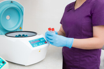 Doctor with test tubes on a plasma therapy centrifuge. plasma lifting