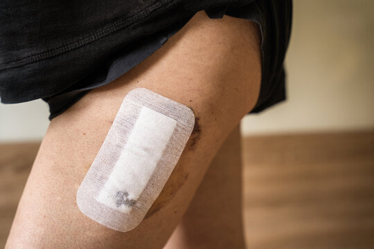 Selbstportrait nach Oberschenkelhalsbruch und nach Operation