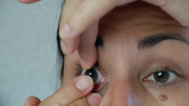 Close-up of a woman wearing soft contact lenses over her eyes against a white background. Myopia.