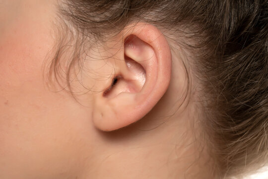 Female Ear With Ear Ring Hole