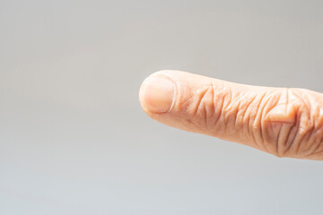 Fingernails and wrinkled skin of an old man