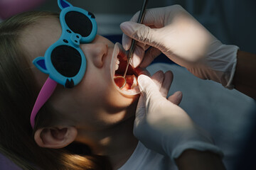 examination of the mouth of a little girl. regular visits to dentist