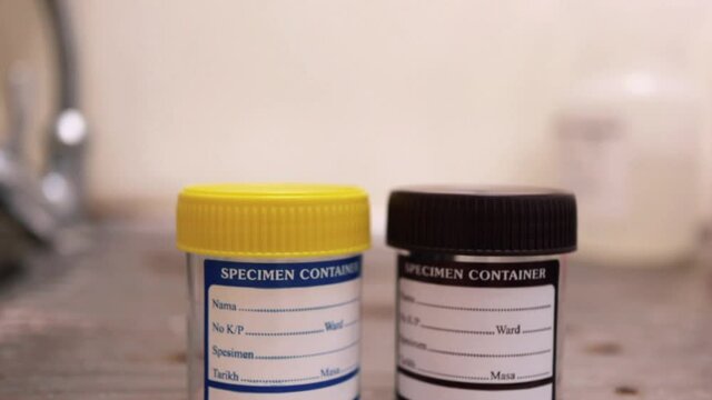 closeup clip of a urine or stool  specimen container 