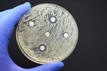 Detecting antimicrobial resistance by Kirby Bauer diffusion test - obrazy, fototapety, plakaty