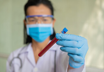 Coronavirus Covid 19 infected blood sample in sample tube in hand of scientist doctor biohazard...