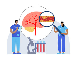 Brain stroke ishemic
