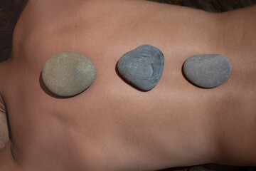 The back of a man, on which round stones are located along the line of the spine. Treatment, relaxation and spa treatments