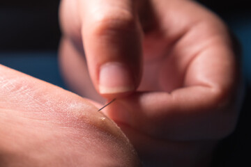Women's fingers pierce a callus on the heel with a needle