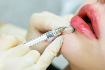 lip augmentation procedures in the beautician's office. changing the shape of the lips using a injecting method. doctor cosmetologist makes an injection in the lip of a woman
