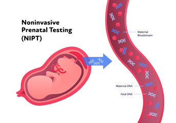 Noninvasive parental testing NIPT concept. Vector flat healthcare illustration. Genetic test. Baby in womb, blood vessel, dna spiral symbol. Design for healthcare, pharmacy, family planning - obrazy, fototapety, plakaty