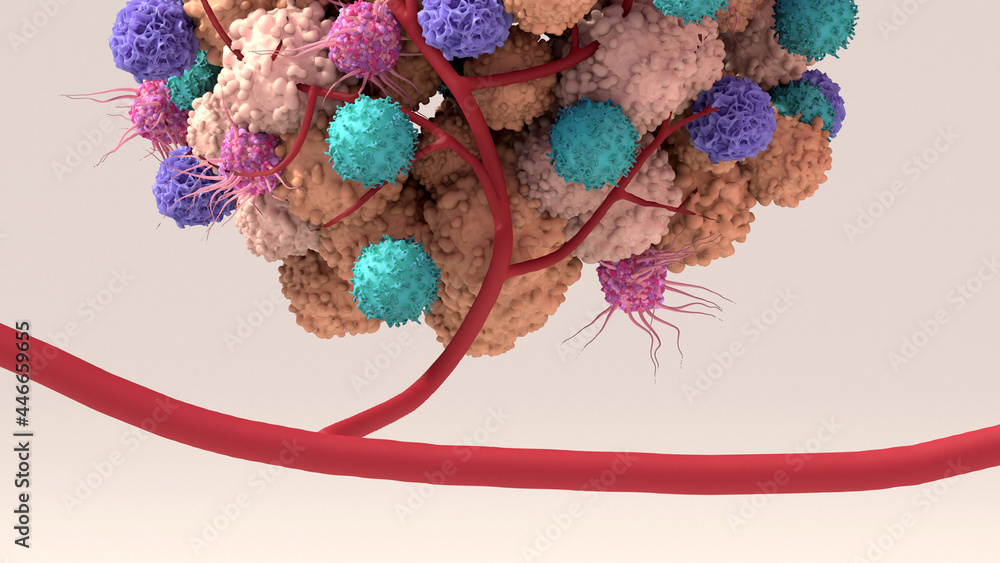 Wall mural Tumor microenvironment, normal cells, molecules, and blood vessels that surround and feed a tumor cell. Microenvironment can affect how a tumor grows and spreads.