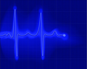 Electrocardiogram. Digital cardiogram, illustration of diagnostic curve cardiogram