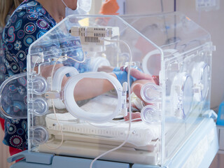 Noworodek w inkubatorze na oddziale neonatologii. Intensywna terapia.  - obrazy, fototapety, plakaty
