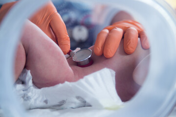 Fototapeta Noworodek w inkubatorze na oddziale neonatologii. Intensywna terapia.  obraz