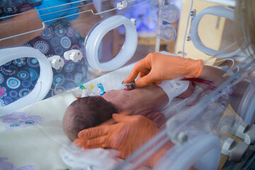 Fototapeta Noworodek w inkubatorze na oddziale neonatologii. Intensywna terapia.  obraz