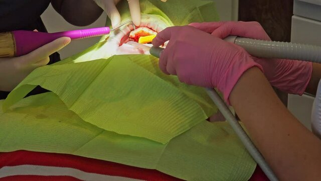 Latvia. Riga. 04.08.2019 Dentist In a Medical Gloves Works with a Patient Man in a Dental Office. Dentistry. Healthcare and Medicine Concept