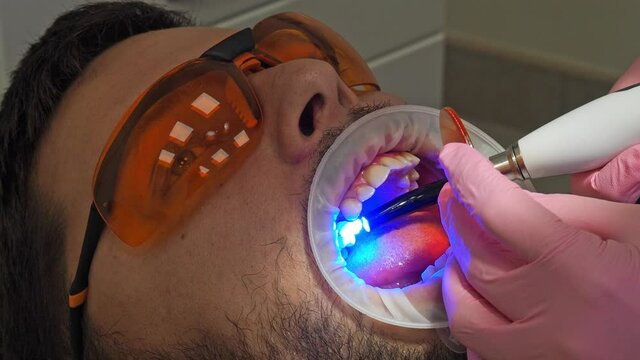 Latvia. Riga. 04.08.2019 Dentist In a Medical Gloves Works with a Patient Man in a Dental Office. Dentistry. Healthcare and Medicine Concept