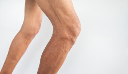 Legs and knee muscles of an old man on a white background.