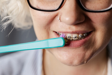 a young woman with braces brushes her teeth with a toothbrush close-up. The concept of oral hygiene and health care