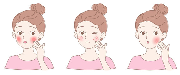 Three types of facial skin problems, allergic skin itching, acne and dry skin