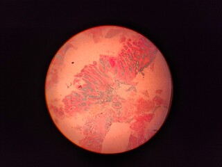 microscopic image of a human tissue stain slide. histology stain.